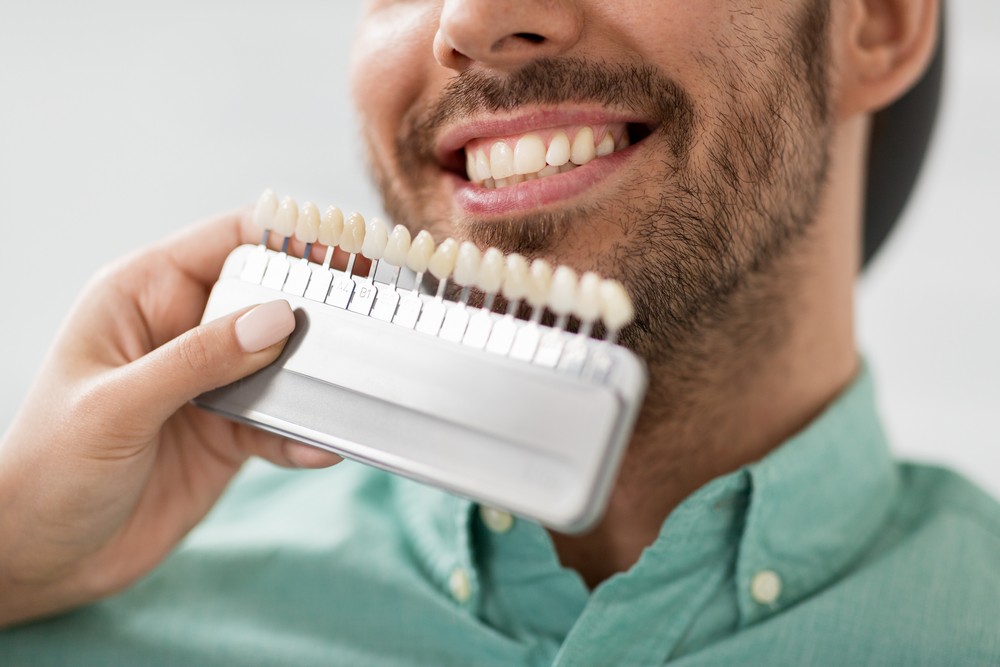 fatete dentare iasi, klar dental concept iasi, stomatologie iasi, albire dentara iasi